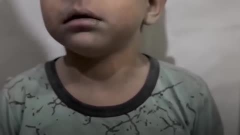 Palestinian child in shock after serviving israel attack in gaza