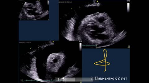 Заседание №176 в записи