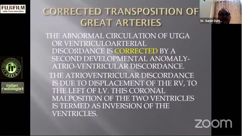 chest Xray finding in different heart diseases