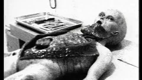 Alien Autopsy