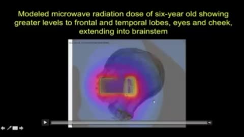 Radiation we expose to ourselves and children