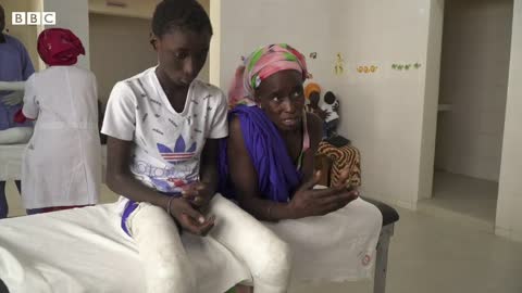 Clubfoot treatment turning lives around in Senegal - BBC News