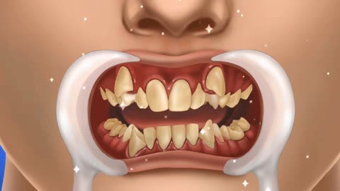 Dental care animation,[ASMR] My teeth hurt so much! (2)