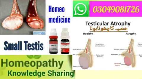 Small Testis ( Testicular Atrophy خصیہ کاچھوٹاہونا) Homeopathic medicine for small testis hindi/urdu