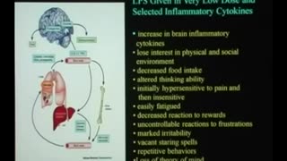 Vaccines And Brain Development - Dr Russell Blaylock, MD (2008)