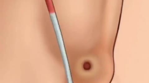 ASMR Removal Satisfying Video