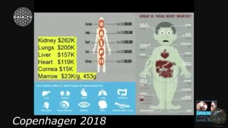 MAX IGAN- Human harvesting is BIG$$$ BUSINESS!!