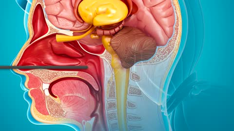 Nasopharyngeal Swab for COVID-19