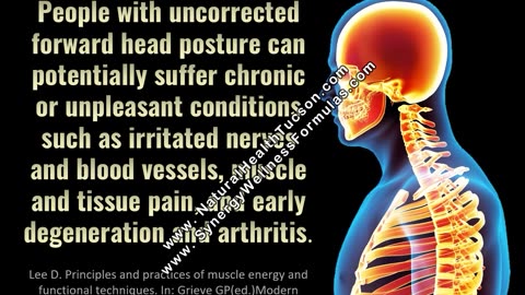 Research/Facts: Accidents, injury, pain, forward head posture, thyroid, drugs, posture!