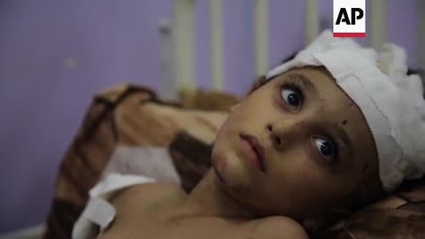 Severely injured children lie in Gaza hospital, while more than thousands killed in three weeks of w