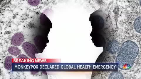 WHO Declares Monkeypox A Global Health Emergency As Cases Skyrocket