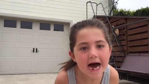 Volleyball Hit Tooth Removal