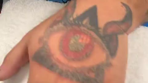 Singer Jimmy Levy Posted A Clip Of Him Getting ‘Satanic Tattoo’ Removed