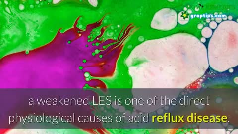 Acid Reflux Treatment ✔️🥦 Causes of Acid Reflux