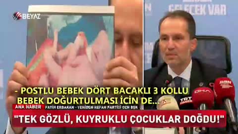 TV turca afferma nascite deformi dopo vaccini antiCovid?