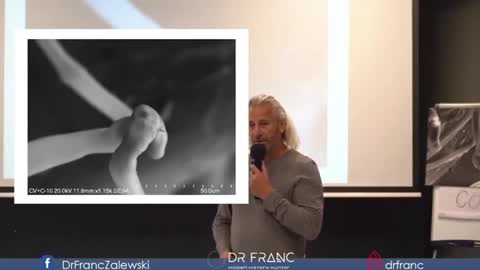 COŚ bardzo niebezpiecznego jest w szczepionkach Dr Franc Zalewski