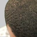 Myrons_Lost_Hair