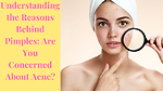 Cracking the Code of Pimples|| Are Pimple Worries Bothering You?