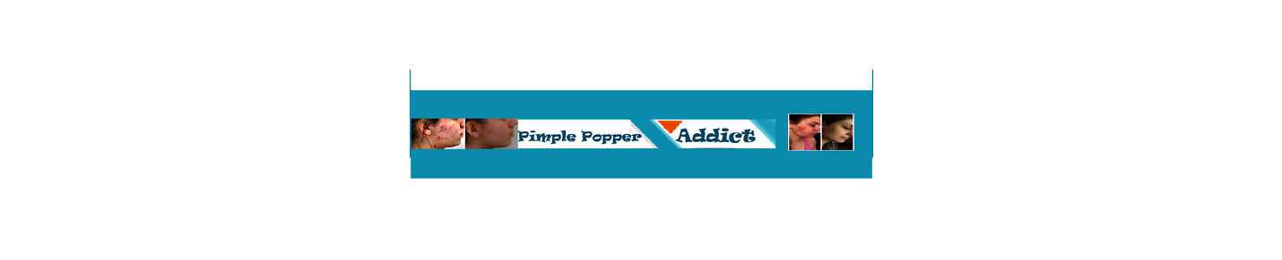 Pimple Popper Addict