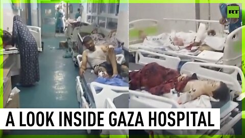 ‘Finished surgery, no place to accommodate him’: Gaza doctor shows overcrowded hospital