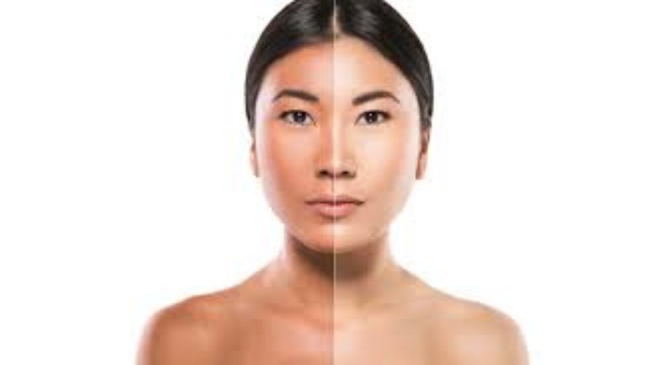 Hidden Dangers of Skin Bleaching