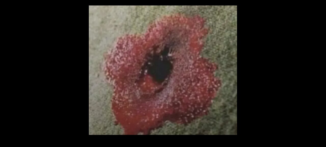 LEST WE FORGET