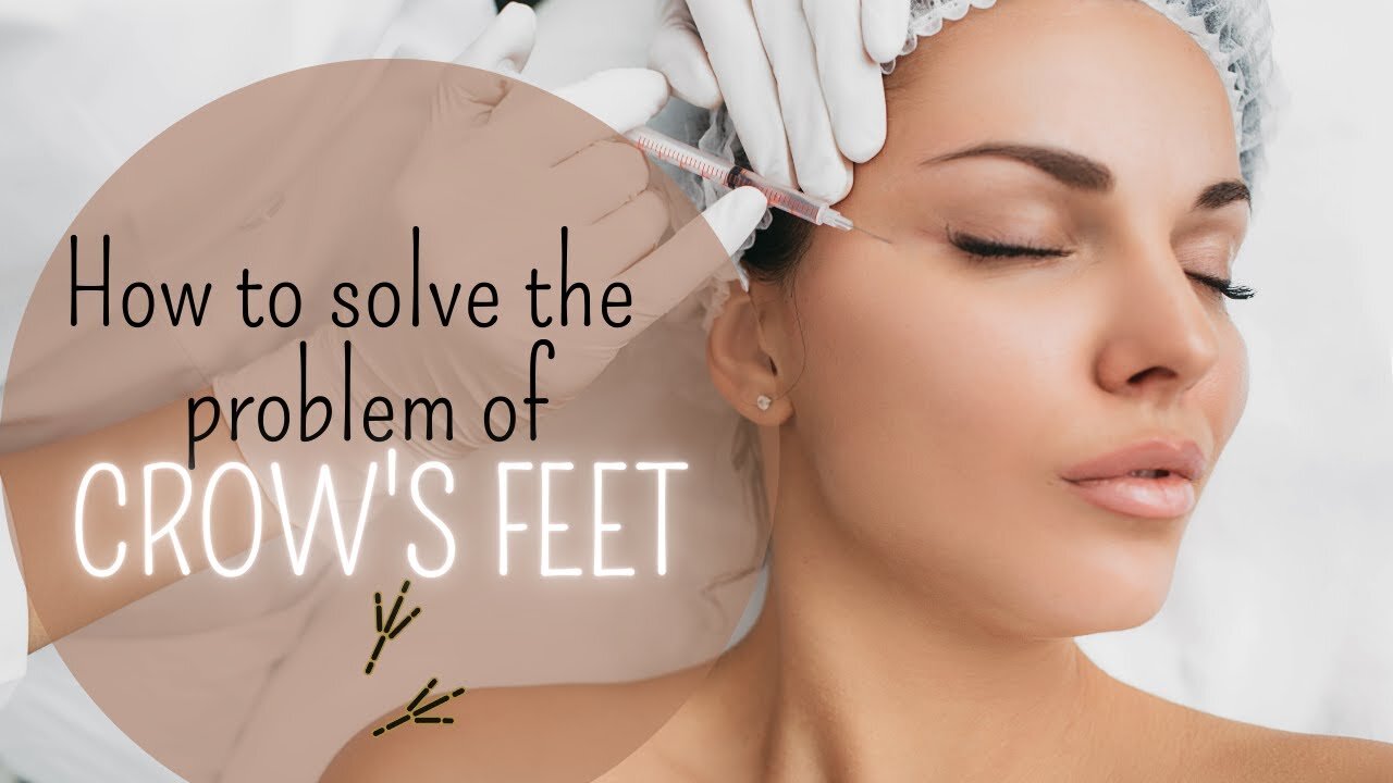 How to solve the problem of CHICKEN FEET around the eyes
