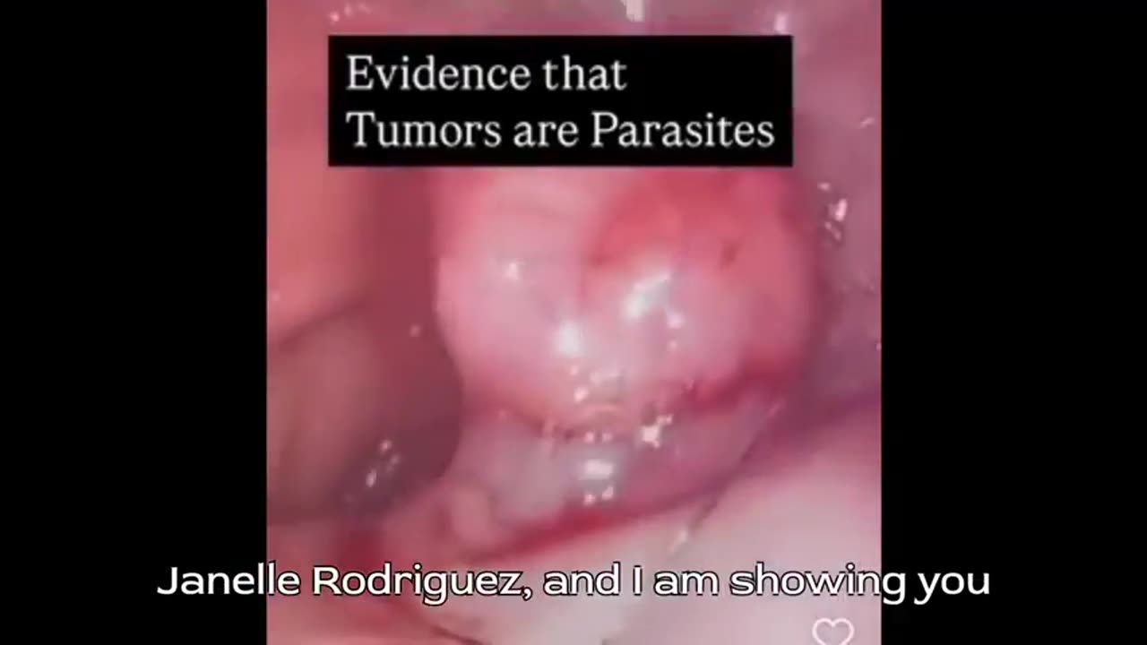 WHAT YOURE ABOUT TO SEE HAS BEEN IGNORED AND COVERED UP ALL OVER THE WORLD!