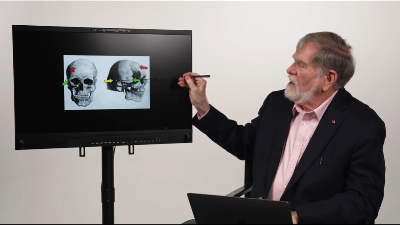 Doug Horne on the JFK Three Headshot Scenario with which Drs Chesser and Mantik Both Agree