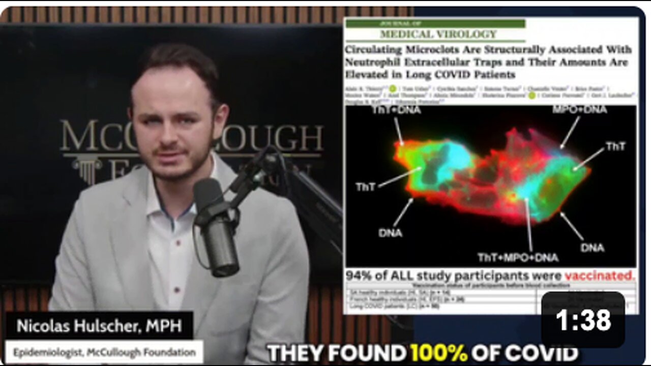 Amyloid microclots were found circulating in the blood of EVERYONE that received a COVID-19 vaccine in a new peer-reviewed study