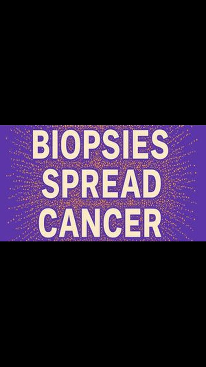 Biopsies spread cancer