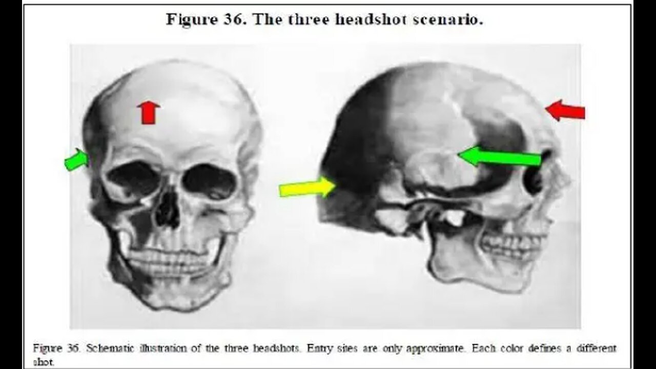 Presentation of Dr. David Mantik on JFK Three Headshot Scenario Followed by Doug Horne Re Same
