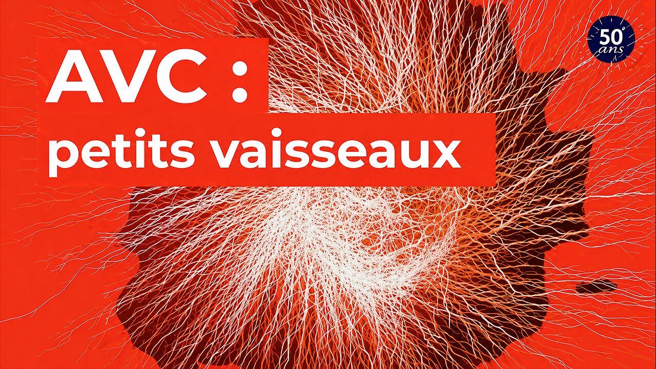 AVC : zoom sur les petits vaisseaux sanguins du cerveau | Inserm [Flokossama]