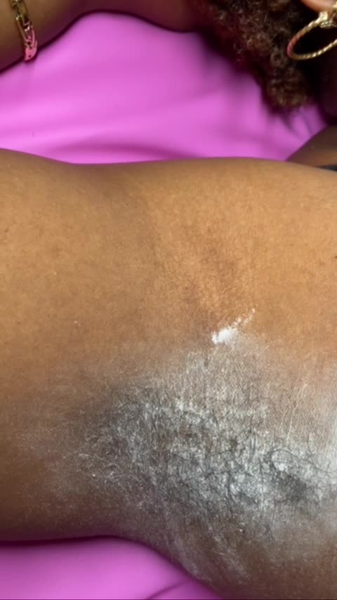 Underarm Waxing in California Using Sexy Smooth Lemon Kiss Wax by @waxing_with_mie ππ