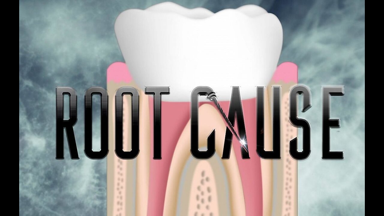 Root Cause...