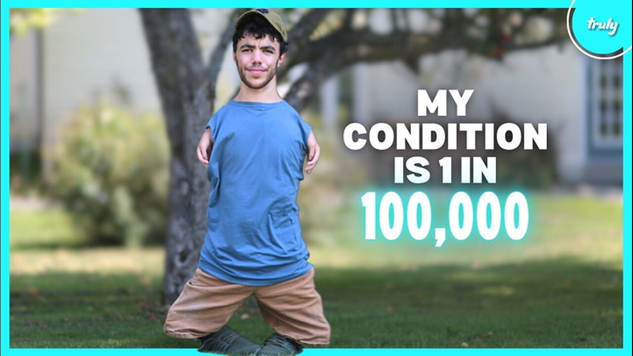 My Rare Limb Difference Made Me Go Viral | BORN DIFFERENT