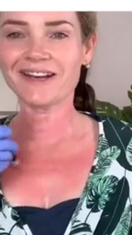MICRONEEDLING Session #7 video