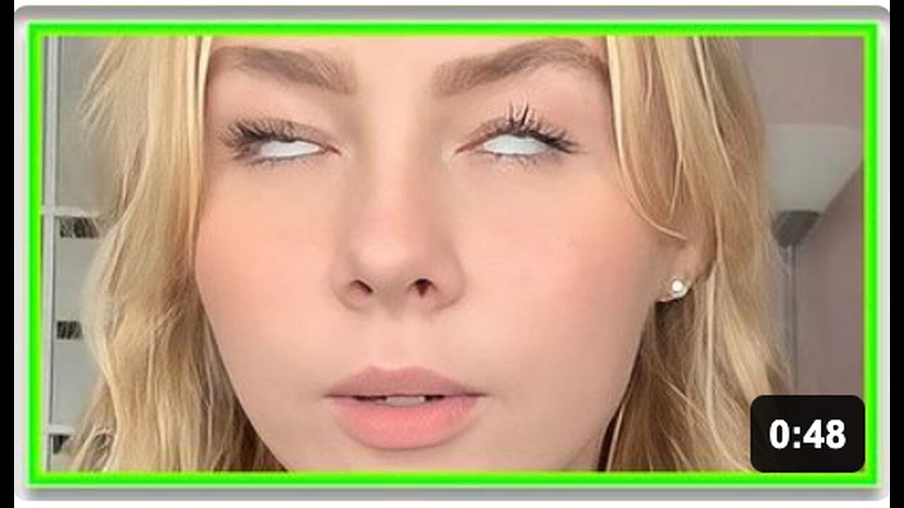 Docs baffled by womans sudden & bizare eye problem