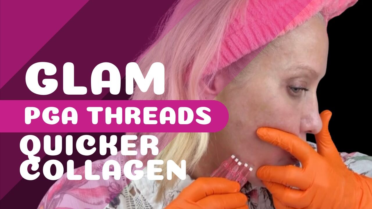 Glam PGA Threads - Nasalabial Folds, Lip Lines, Jawline Tightening
