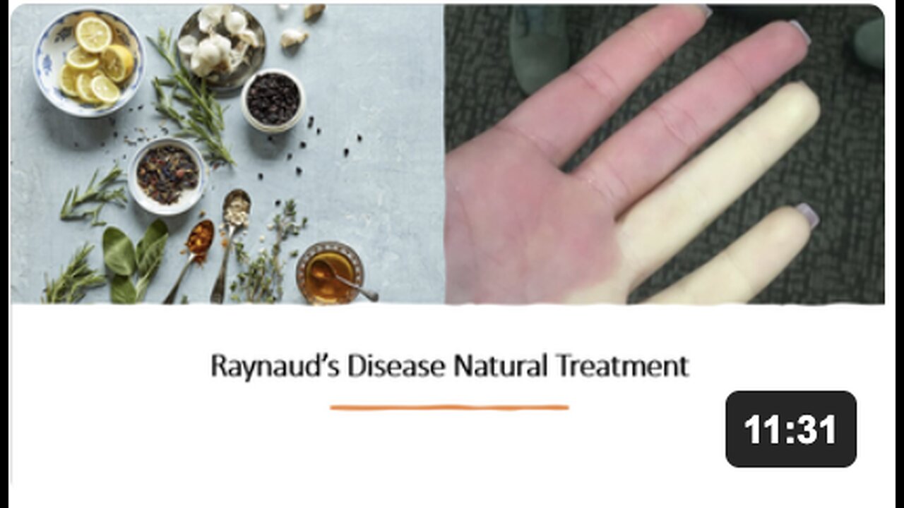 Raynauds Disease Natural Treatment