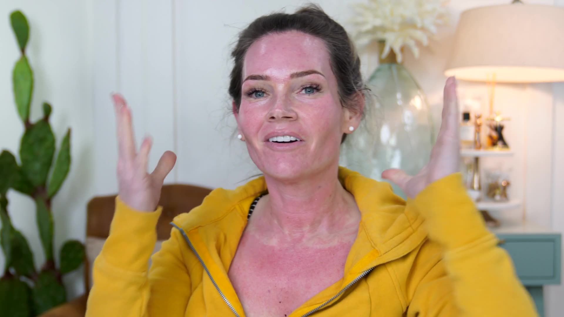 Microneedling Demonstration video