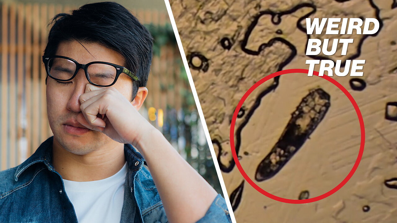 Gross eyelash mites live rent-free on your face — heres how to stop them | Weird But True