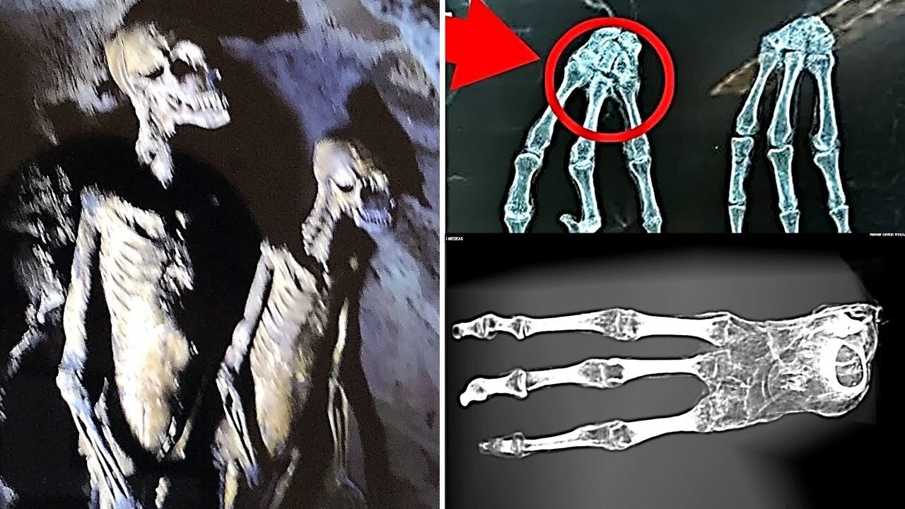 They Just Released A New Video Of The Nazca Mummies They Are Not Human