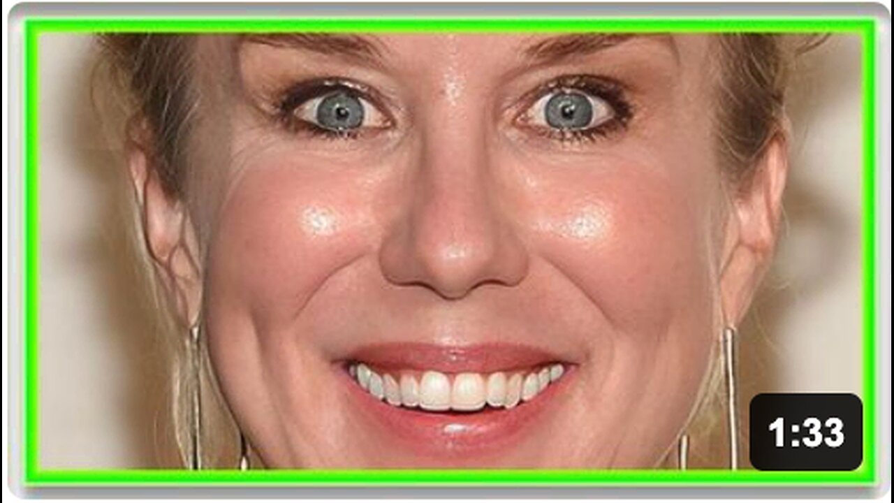 Comedian suffers VAXX induced BELLS PALSY