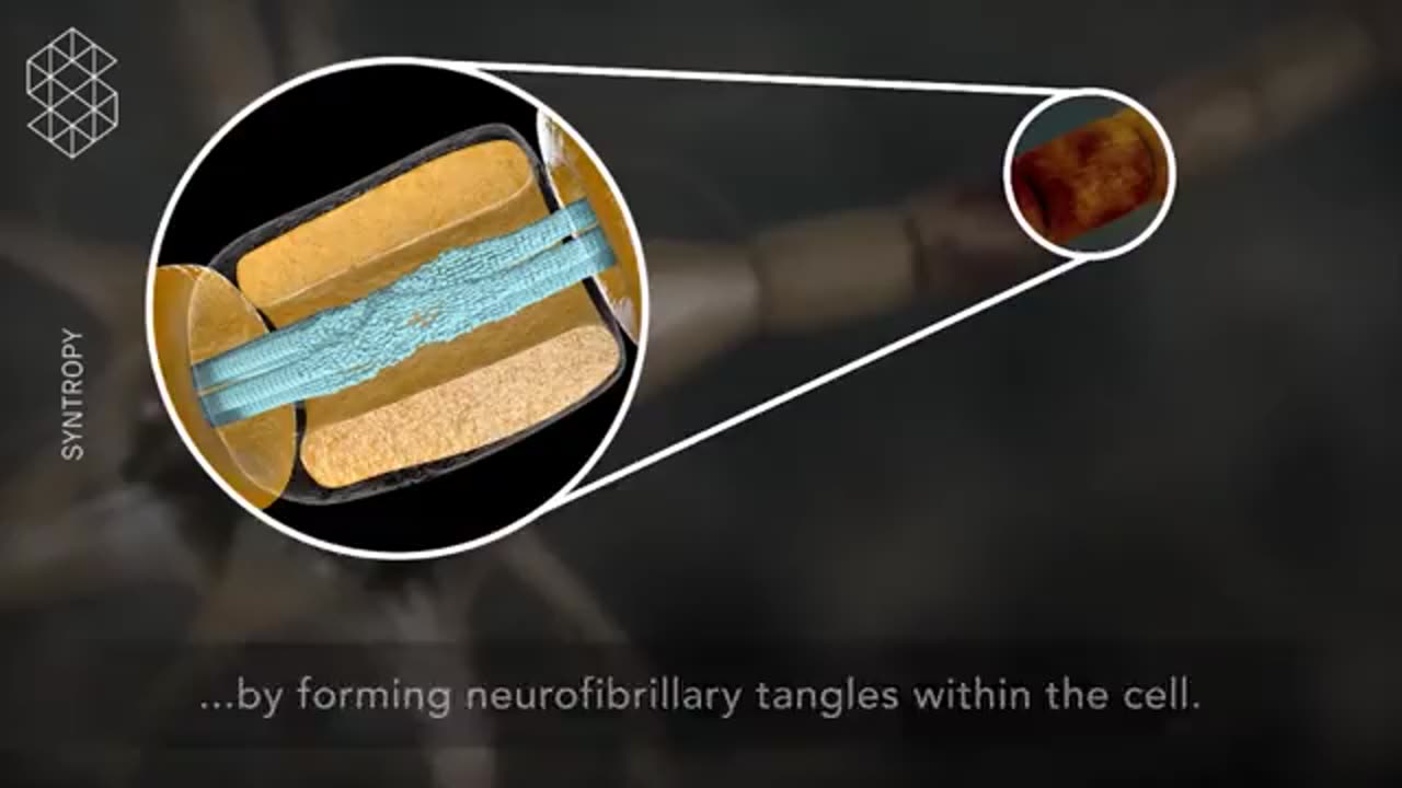 The effects of a concussion on brain cells