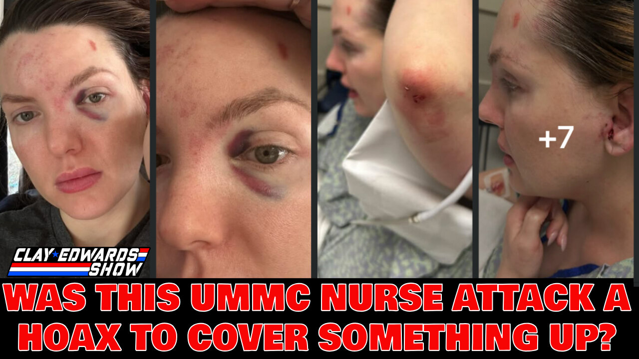Why We Think The Alleged UMMC Nurse Attack Video Could Be A Hoax