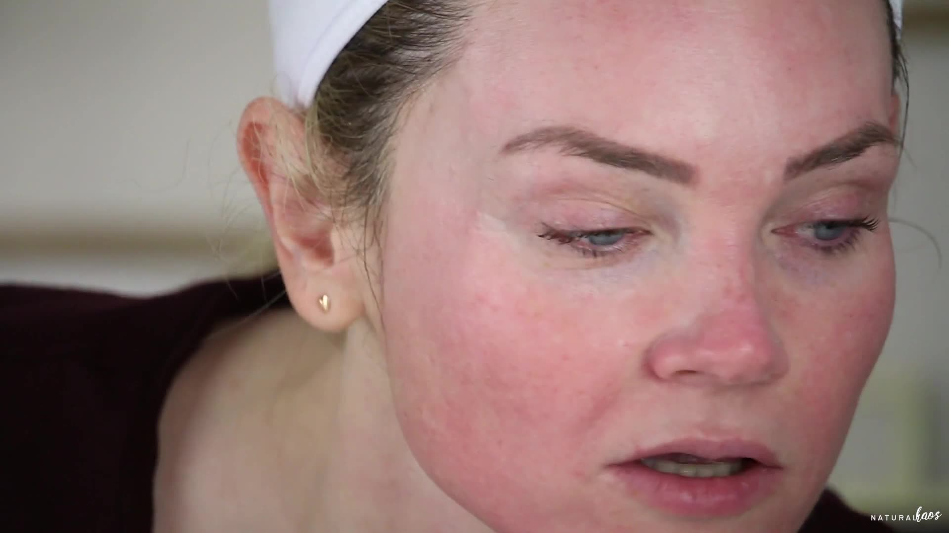 Matrigen B-TOX Acid Peel video