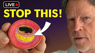 This One Habit is Clogging your Arteries