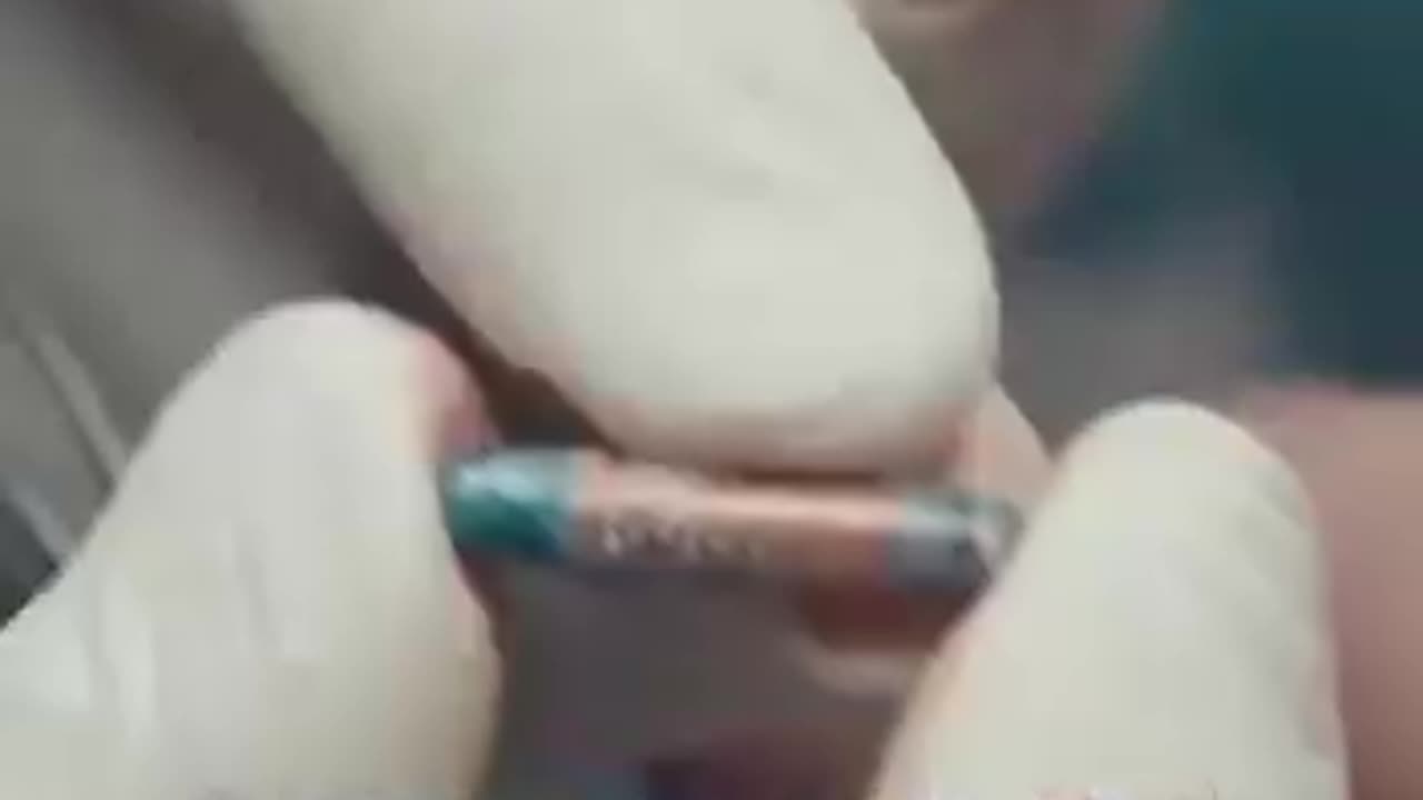 Most of you have been chipped 😀
