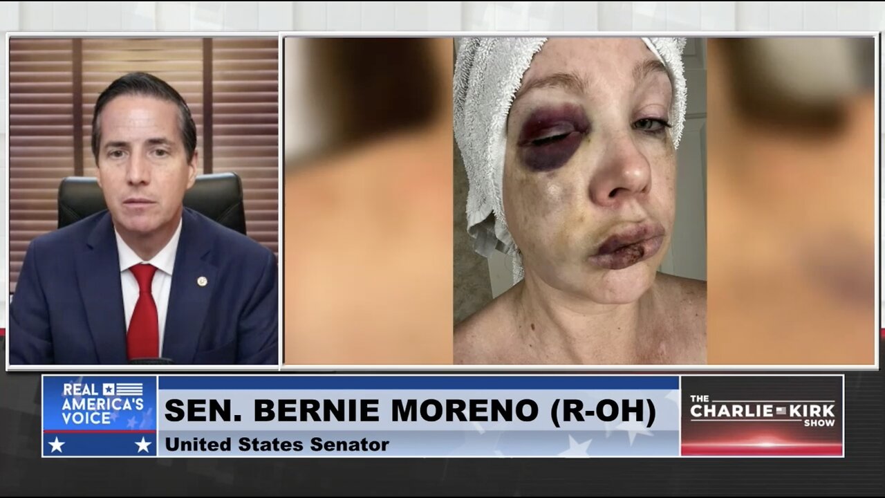 White Woman Nearly Beaten to Death By Black Mob: City Council Member Says She Begged For It